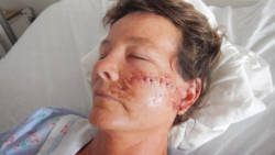 Christina Curtin after the Oct. 3, 2013 attack. 