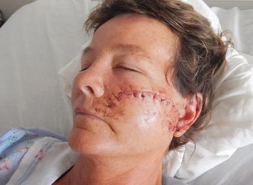 Christina Curtin after the Oct. 3, 2013 attack. 