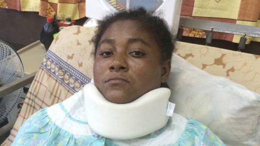 Sandy Bay resident Shirley Baptiste's right leg was amputated as a result of her injuries. (IWN photo)