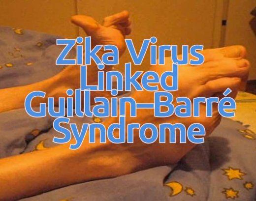 scientists discovered guillain barre syndrome linked zika virus