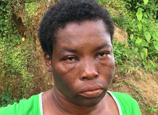 Jesgil Letteen says he has endured a life of abuse because she has nowhere to live. (iWN photo)