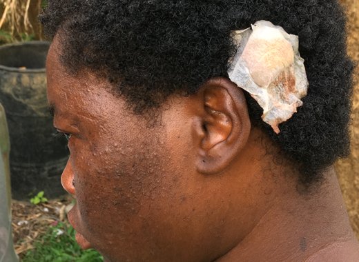 Letteen suffered a cut to the head during the cutlass attack. (iWN photo)