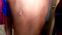 Abused boy