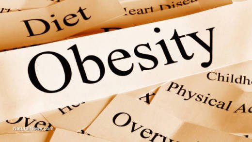 Obesity
