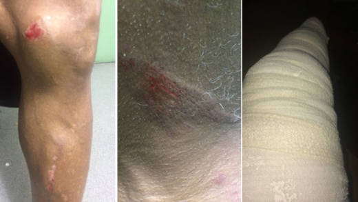 St. Clair Harris, 68, of Sharpes Dale, sustained injuries to his leg and neck, resulting in his leg being placed in a cast. 