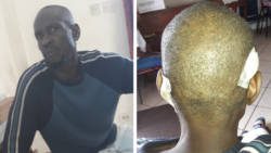 Cordel Nedd and the injuries he reportedly sustained at the hands of police. 