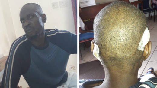 Cordel Nedd and the injuries he reportedly sustained at the hands of police. 