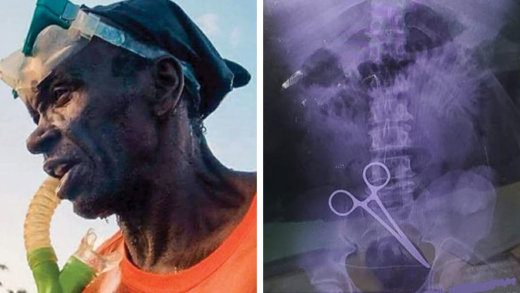 Arnott Hope, left died at the Milton Cato Memorial Hospital after a surgical tool was reportedly stitched up in his abdomen, purportedly shown at right.