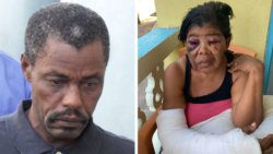 Accused wife beater, Dennis Shallow, left, outside Kingstown Magistrate court, on Tuesday, and his wife, Marilyn Chance-Shallow in the days after the alleged beating. (Photos: iWN & Facebook)