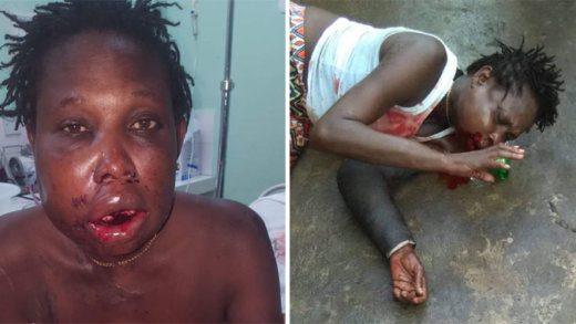 Monique Hutchin in the aftermath of the attack on Thursday.