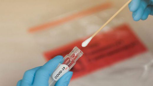 Covid 19 test