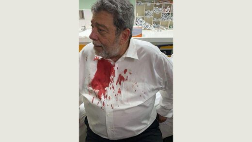Bloodied Ralph Golsalves