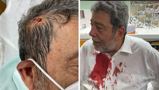 The injured Gonsalves at Milton Cato Memorial Hospital.
