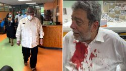 At left: Prime Minister Ralph Gonsalves leaves the Queen Elizabeth Hospital In Barbados, on Friday. He is seen, at right, at the Milton Cato Memorial Hospital on Thursday evening. 