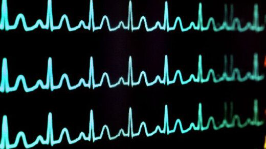 Life support