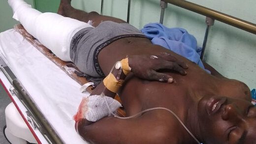Cjea Weekes, 18, in hospital after the accident on Wednesday, Feb. 2, 2022. 