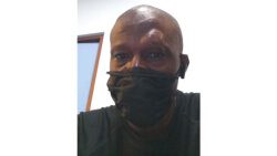 Referee Rohan Primus with a swollen left eye after the assault on Sunday, Nov. 6, 2022.