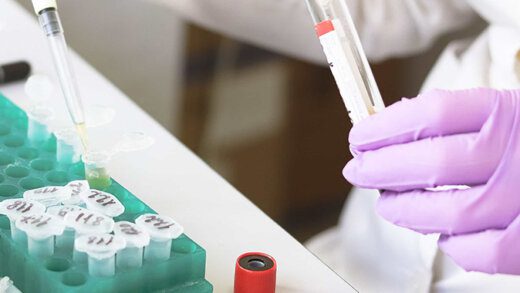 Lab tech