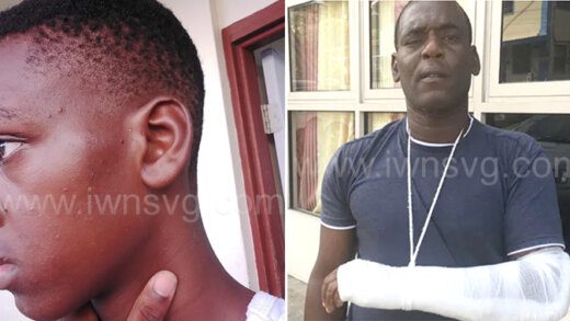 Damali Phillips, 13, left, show his face left swollen after a Vincentian police officer pelted him with a bottle of body lotion at a camp in St. Lucia and his father Dwight Phillips with a an arm he alleged a police officer broke in Kingstown in 2017. 