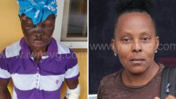 The virtual complainant, Ancelma McKenzie, left, after being burnt and the defendant, Voctoreen McKenzie after her court appearance on Wednesday, Oct. 25, 2023.

