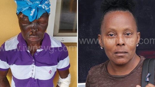 The virtual complainant, Ancelma McKenzie, left, after being burnt and the defendant, Voctoreen McKenzie after her court appearance on Wednesday, Oct. 25, 2023.

