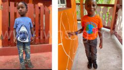 The child, Aveek, Gerald, was born with his left leg shorter than the right, which the surgery was intended to correct.