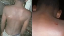 A montage of two screenshots from the video of the boy's back.