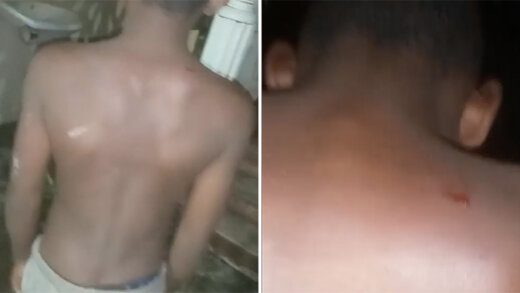 A montage of two screenshots from the video of the boy's back.