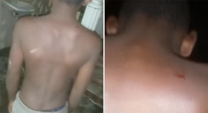 A montage of two screenshots from the video of the boy's back.