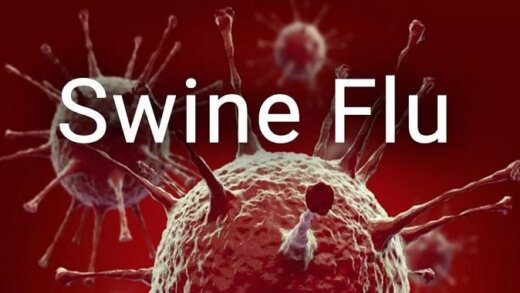 Swine Flu