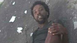 An injured William Holder at the scene after the accident on Monday, Oct. 29, 2024.