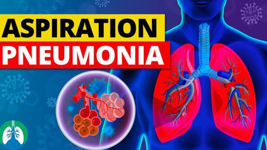 aspiration pneumonia