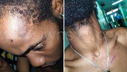 The accused, Tristan Williams, showing injuries he allegedly suffered at the hands of the police. 