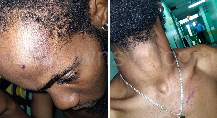 The accused, Tristan Williams, showing injuries he allegedly suffered at the hands of the police. 
