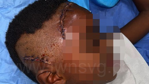 Injured boy