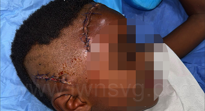 Injured boy