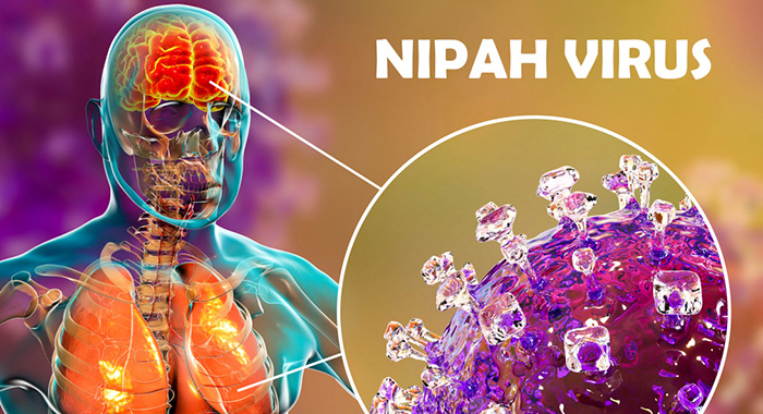 ‘Low risk’ of Nipah Virus in SVG