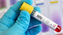 HIV