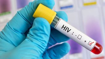 HIV