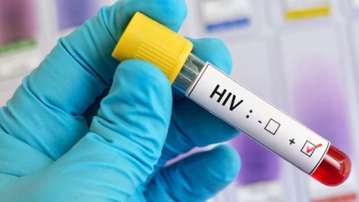 HIV