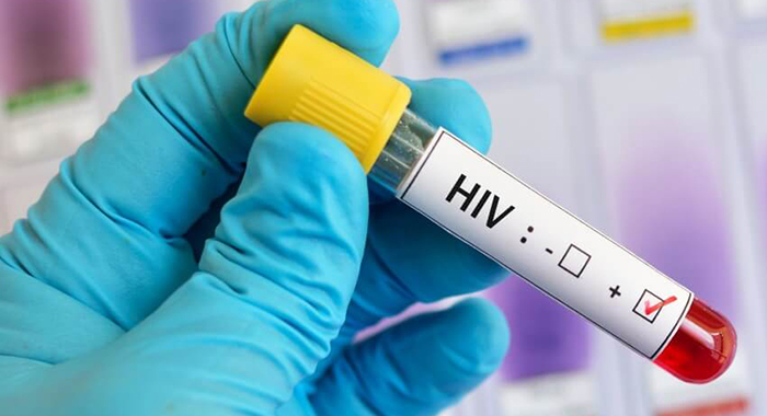 HIV